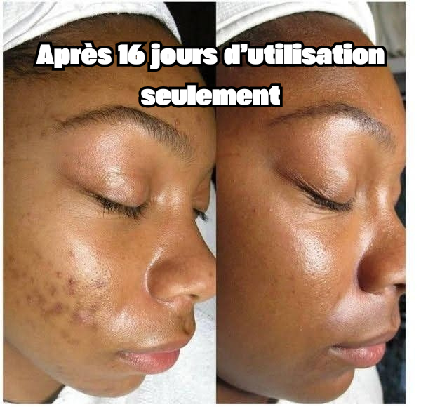 MASQUE AU COLLAGENE